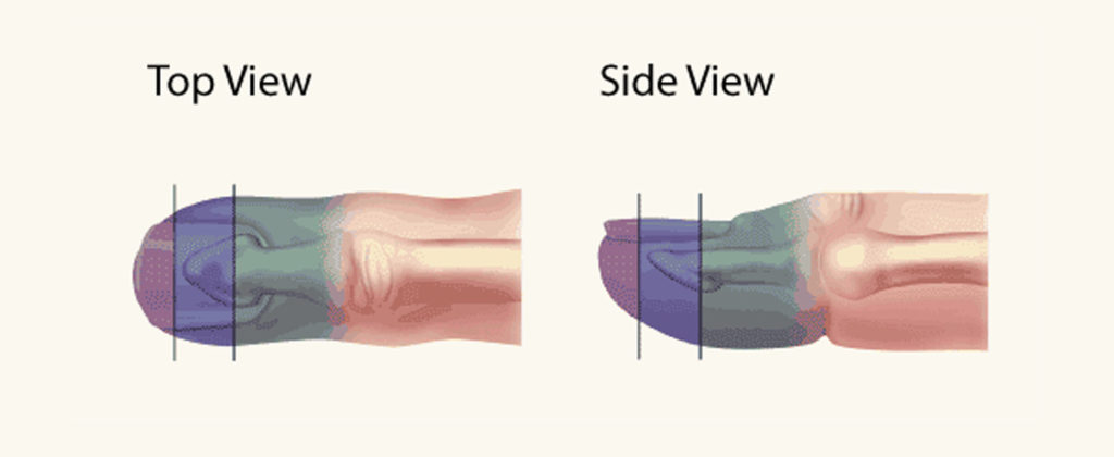 fingertip diagram